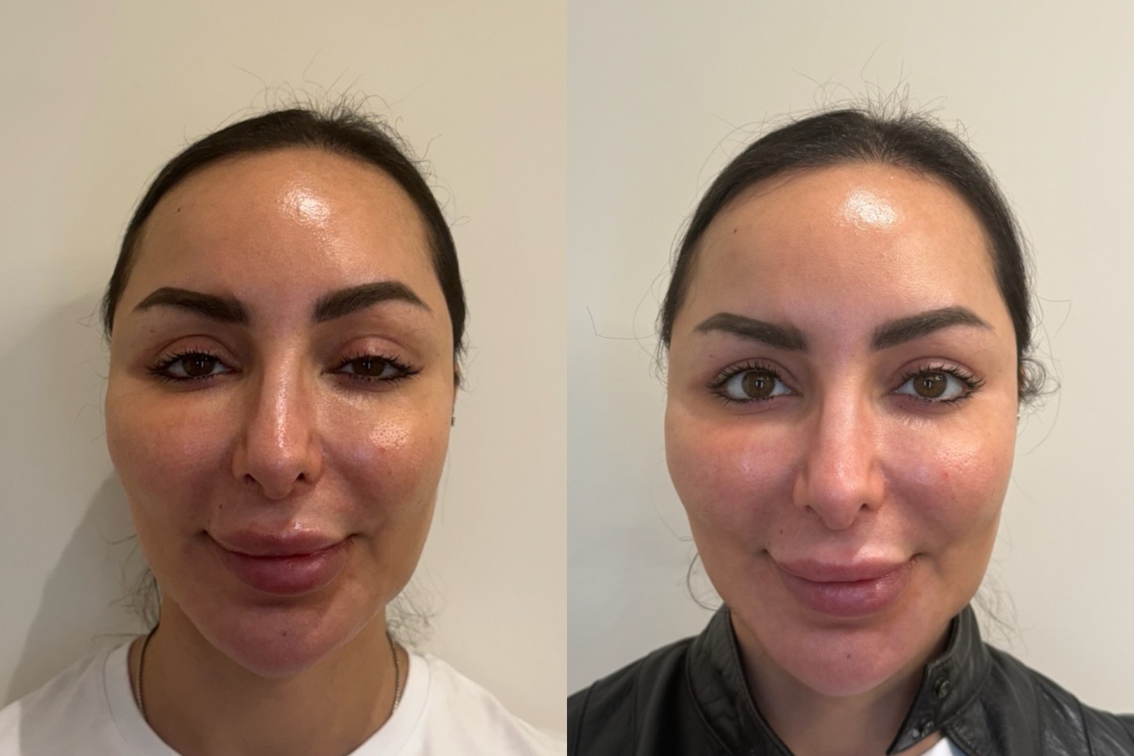 Upneeq Before & After Image