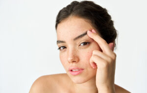 Woman with hooded eyes gently lifting brow to show potential Botox treatment area for non-surgical eye lift.