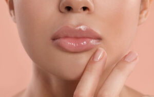 Close-up of full, glossy lips with a natural look, illustrating typical results after stopping lip filler treatments.