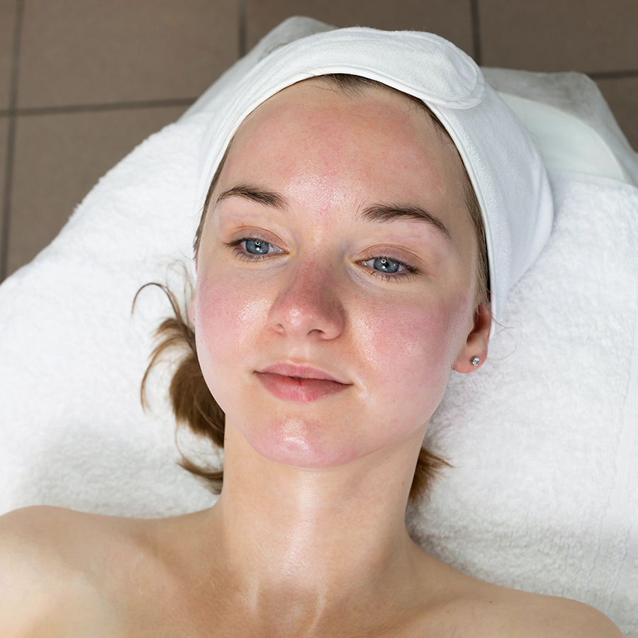 Woman with slightly flushed skin relaxing after microneedling with PRF treatment at AM Beauty & Wellness in Miami.