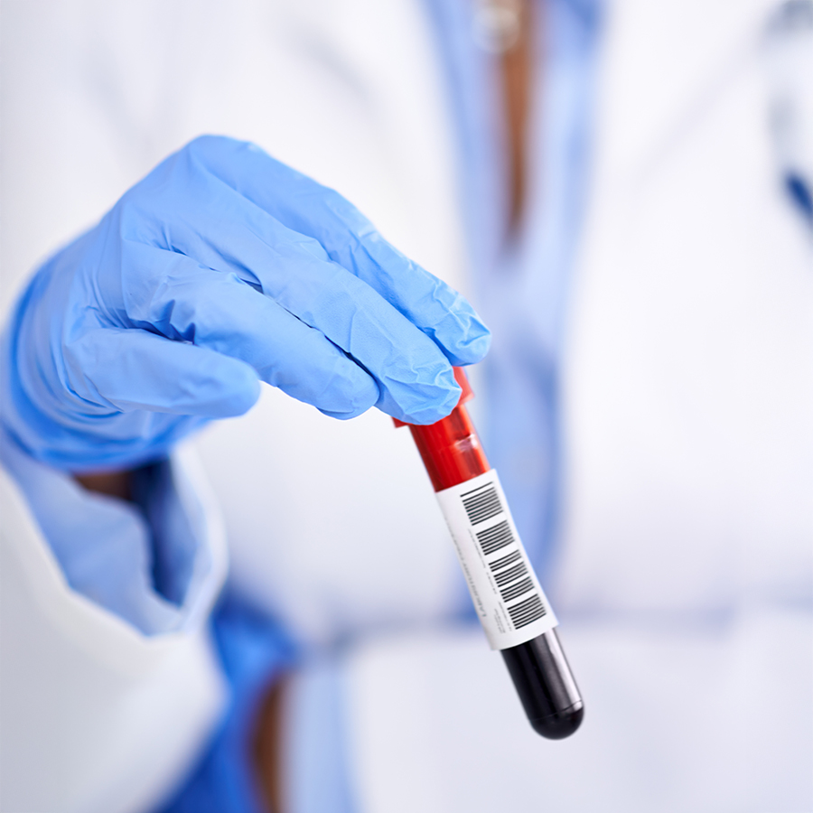 Gloved hand holding blood sample vial, representing advanced diagnostic testing for optimal health at BodyWelle.