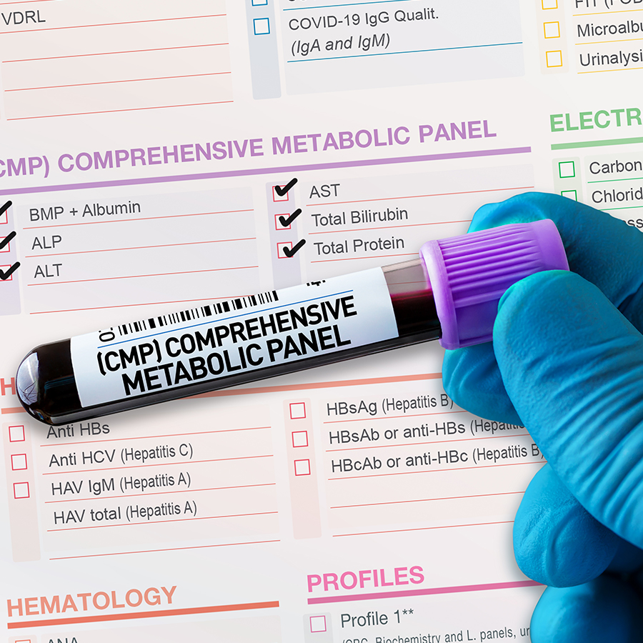 Gloved hand holding CMP blood vial over lab form, highlighting metabolic panel for energy and organ health analysis.