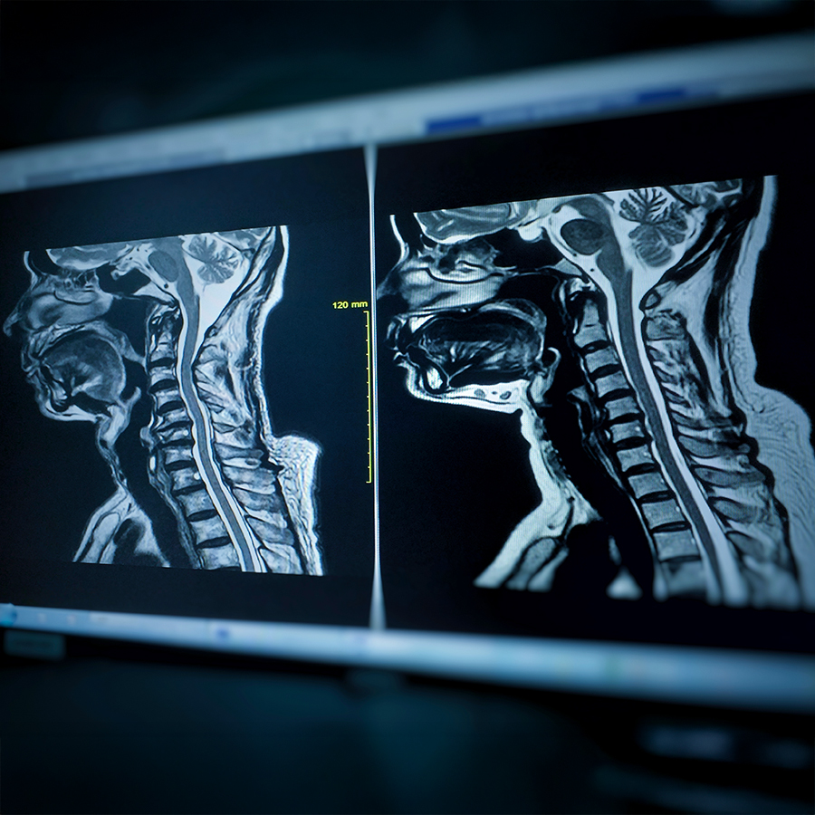 High-resolution MRI images of head and spine on screen, representing full body scan for early health detection