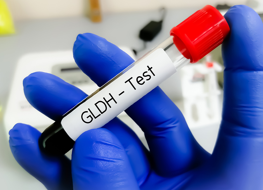 GLDH blood test tube held by gloved hand, used in mitochondrial function testing to assess energy production and metabolism.