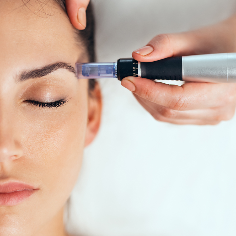 Close-up of a woman receiving a mesotherapy facial near the eyebrow with a precision skin treatment device