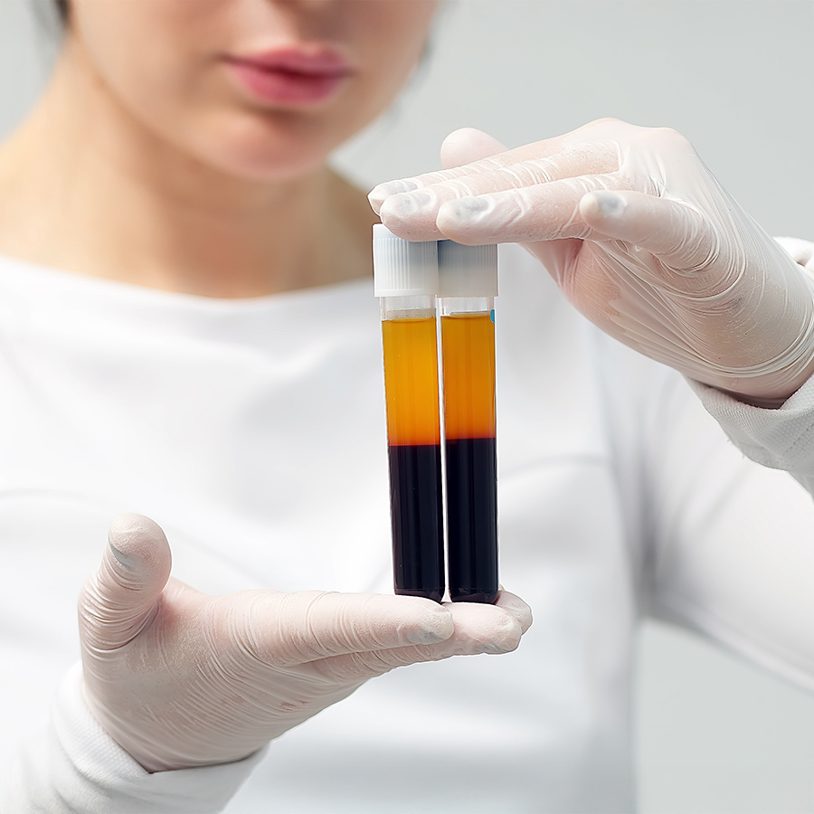 Gloved clinician holding PRP vials prepared from patient’s blood, used in collagen-boosting and skin-rejuvenating treatments