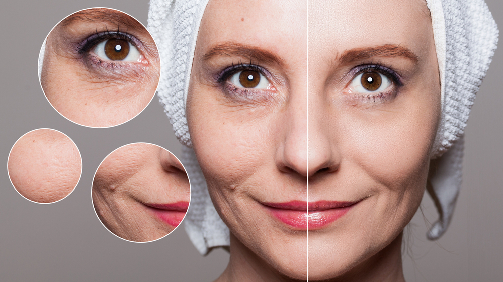 Close-up of woman's face showing before and after skin results from Beauty IV therapy with vitamin support.