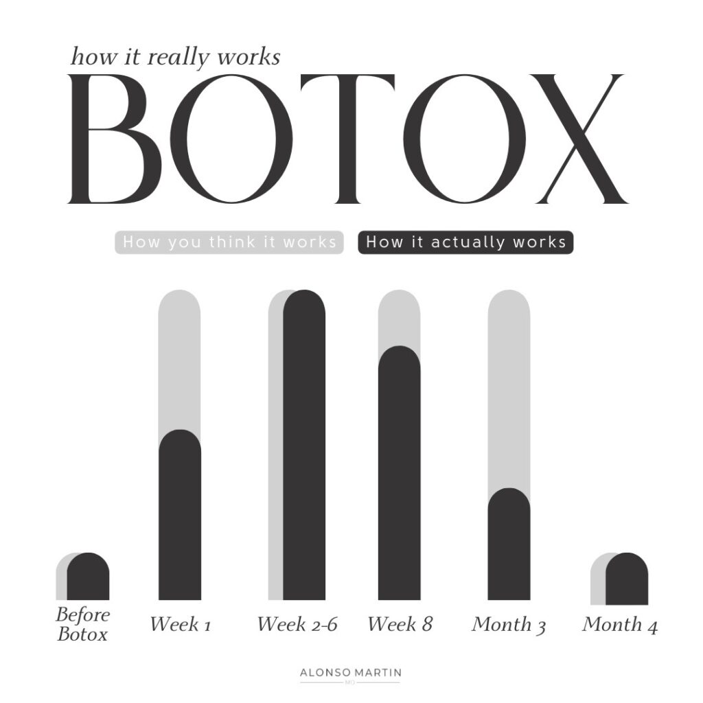 Timeline chart showing how Botox effects peak at weeks 2–6 and decline by month 4, with treatment factors listed.