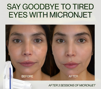 Say goodbye to tired eyes with Micronjet