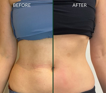 Weight loss BA IG post