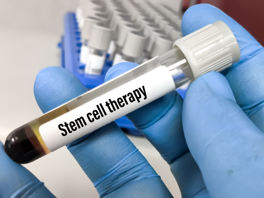 Gloved hand holding vial labeled stem cell therapy, representing research on neuroinflammation and cognitive function improvement