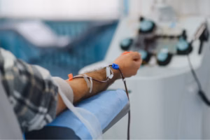 Patient connected to blood-processing tubing during treatment.