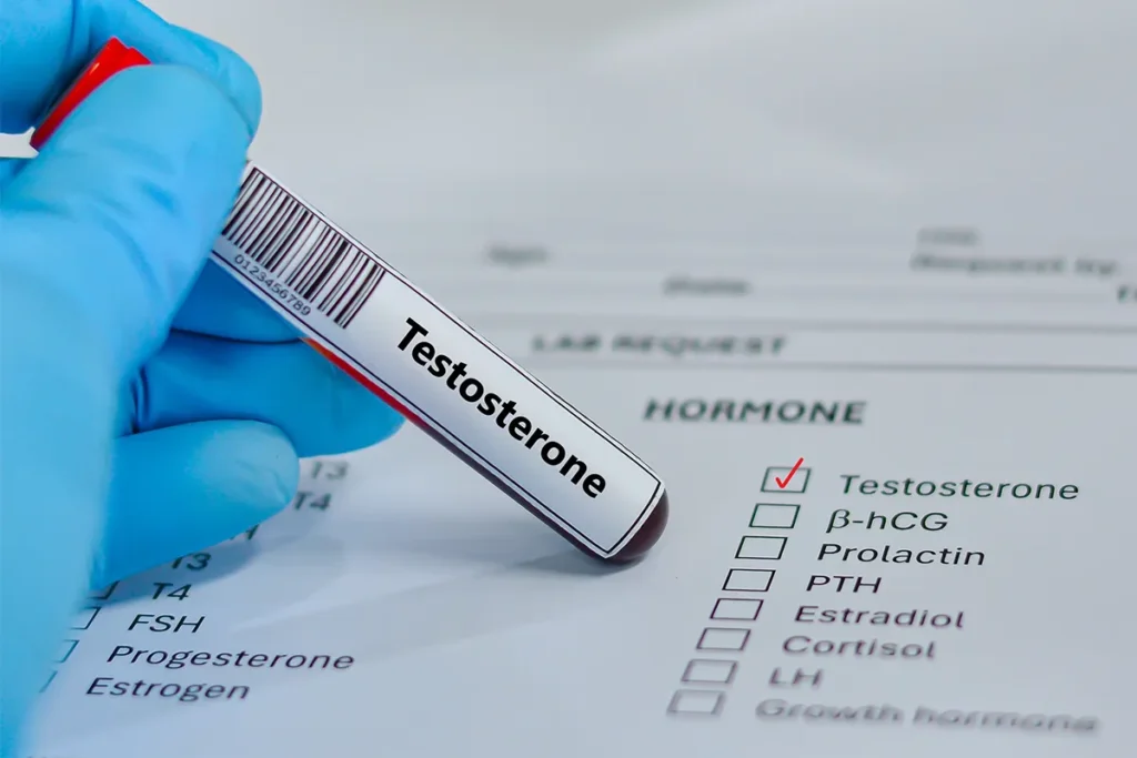 Testosterone blood sample with a hormone testing panel.